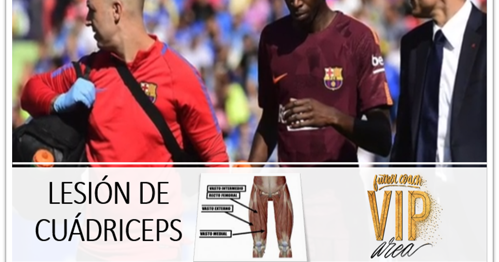 cuádriceps