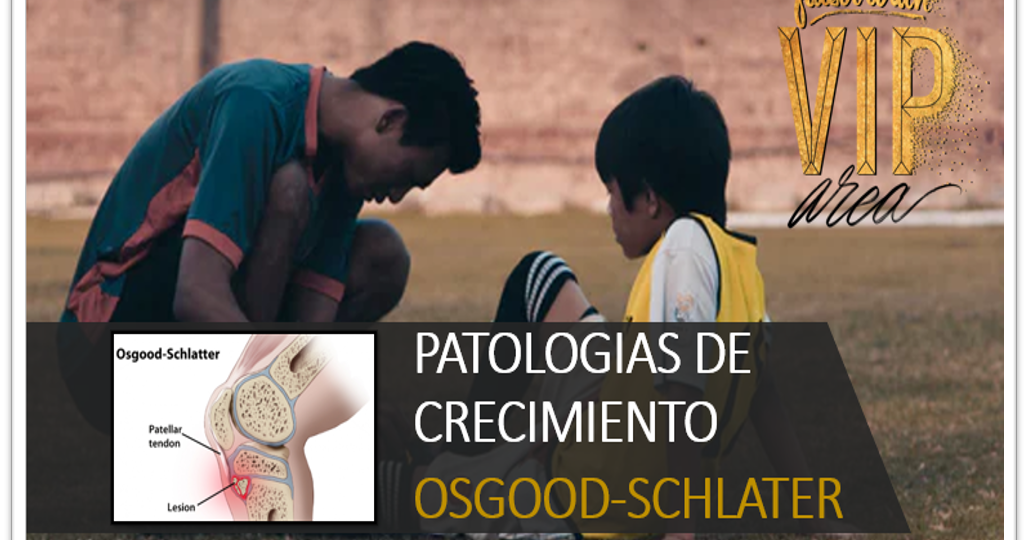 osgood