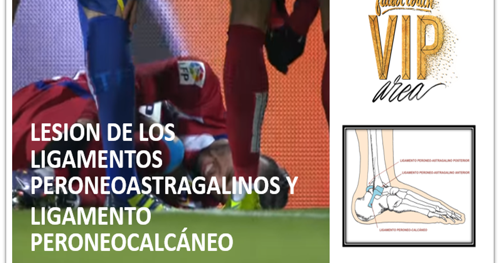 peroneocalcaneo