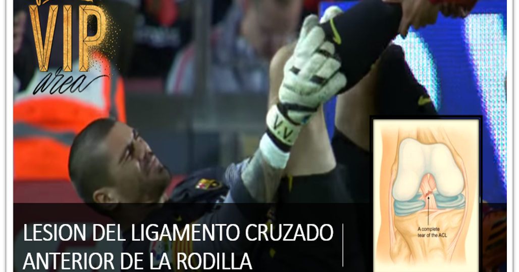 rodilla